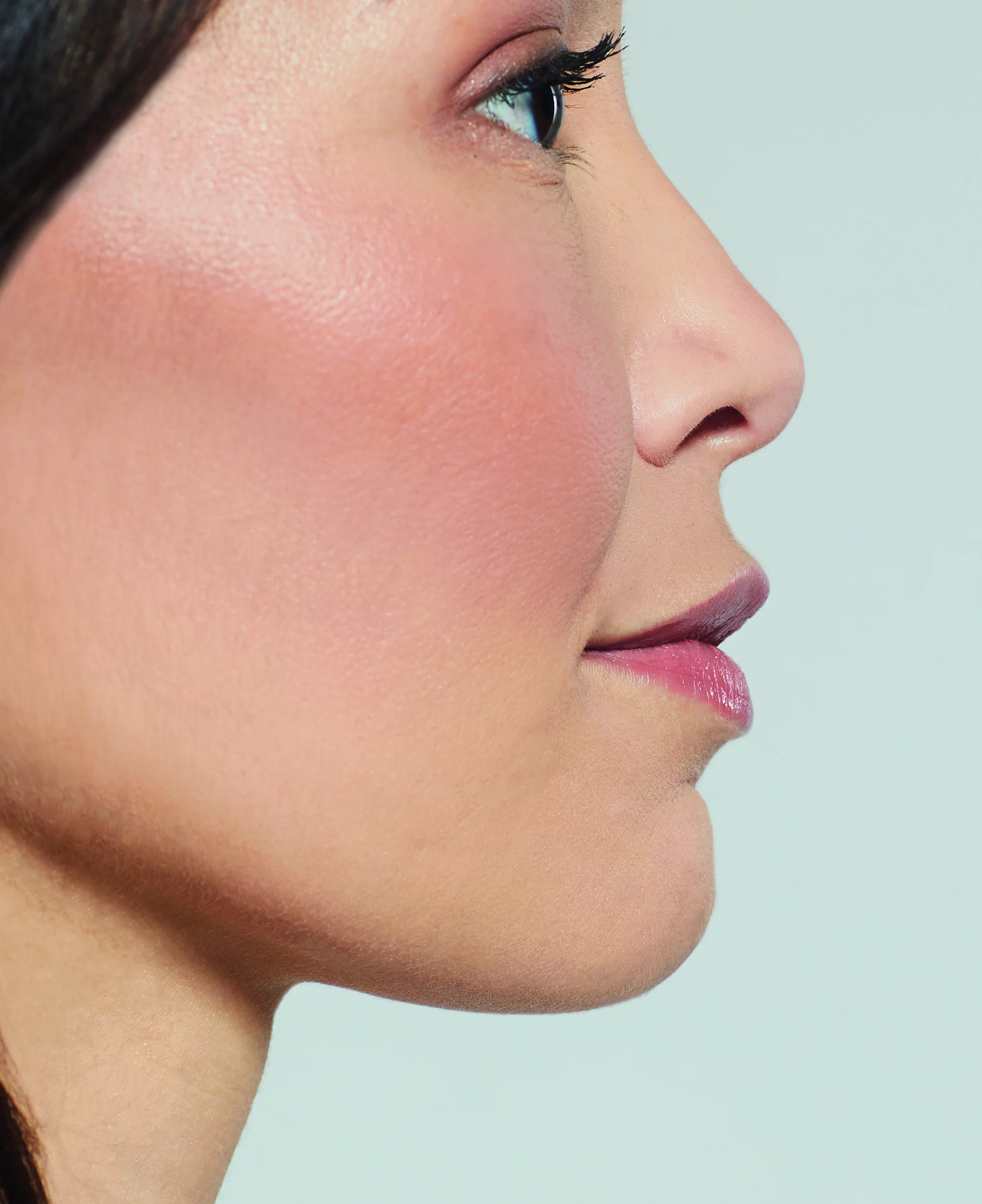 Annishia-detail-2-before