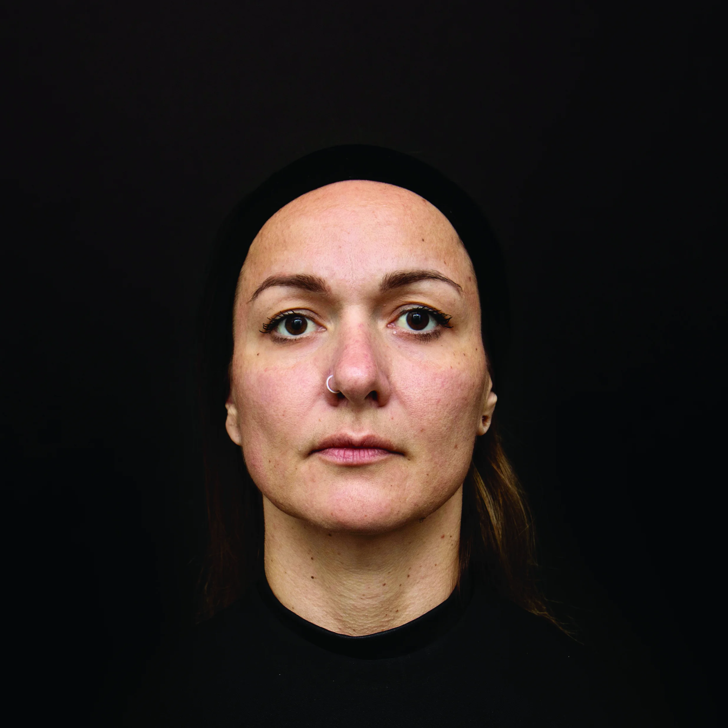 Viviane one year after RT