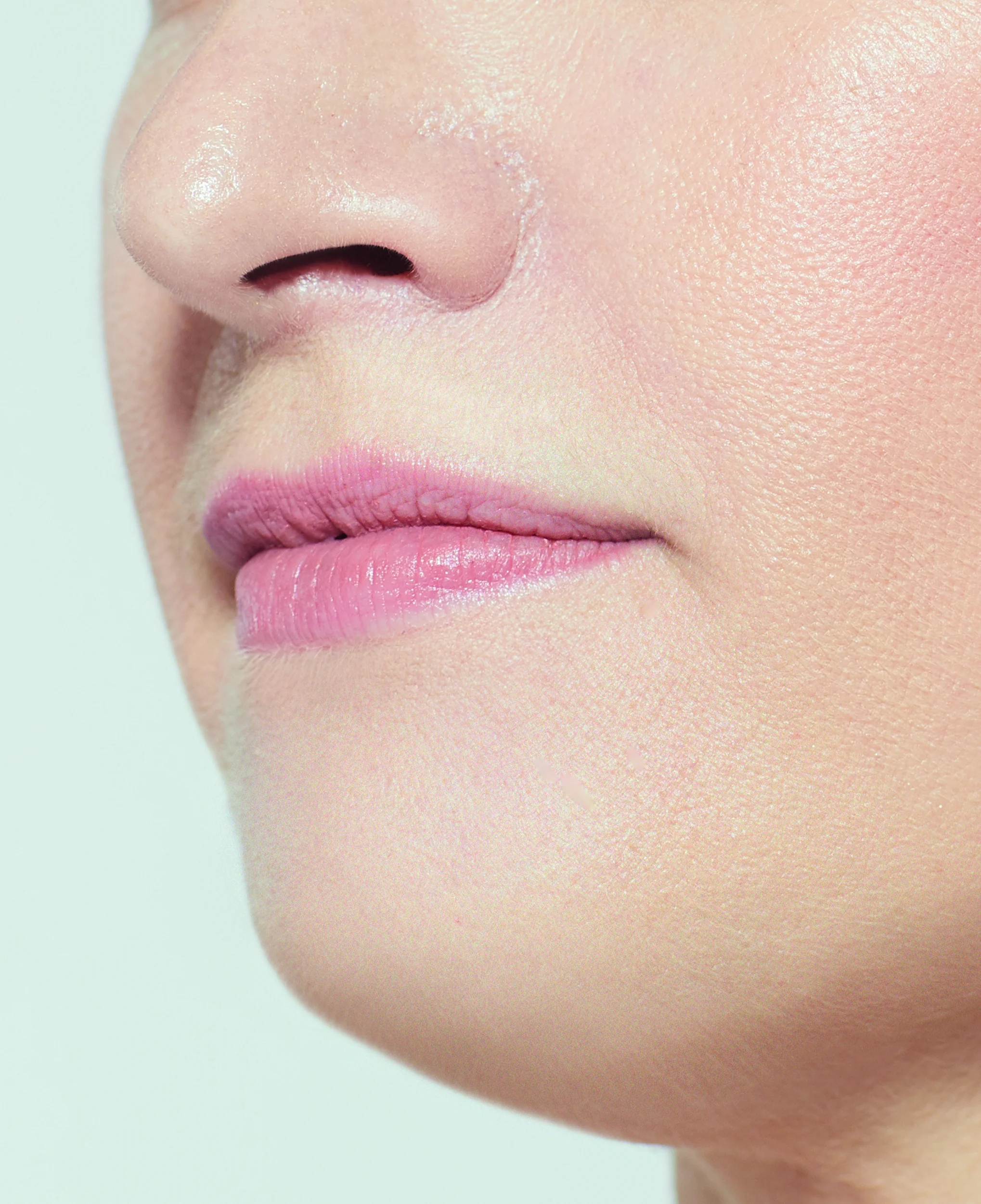 nicole-detail-1-before